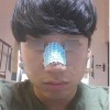 Rhinoplasty Revision — Korea cost, reviews & before-after | MISOODA