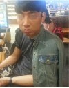 Rhinoplasty Revision — Korea cost, reviews & before-after | MISOODA