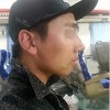 Rhinoplasty Revision — Korea cost, reviews & before-after | MISOODA