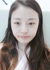 Eyelid Revision — Korea cost, reviews & before-after | MISOODA