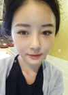 Eyelid Revision — Korea cost, reviews & before-after | MISOODA