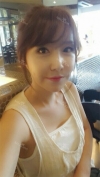 Jaw + Eyelid Revision, Accusculpt, Fat Graft — Korea cost, reviews & before-after | MISOODA