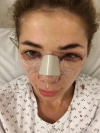 Russian models rhinoplasty, under eye fat repositioning — Korea cost, reviews & before-after | MISOODA