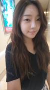 Nose and chin at jk ps clinic and got feminine look — Korea cost, reviews & before-after | MISOODA