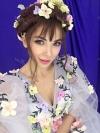 Russian models rhinoplasty, under eye fat repositioning — Korea cost, reviews & before-after | MISOODA