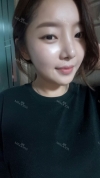 Nose and chin at jk ps clinic and got feminine look — Korea cost, reviews & before-after | MISOODA