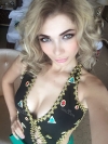 Russian models rhinoplasty, under eye fat repositioning — Korea cost, reviews & before-after | MISOODA