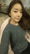 Nose and chin at jk ps clinic and got feminine look — Korea cost, reviews & before-after | MISOODA