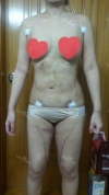 30 years old get your self confidence with a sexy body! — Korea cost, reviews & before-after | MISOODA