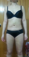 30 years old get your self confidence with a sexy body! — Korea cost, reviews & before-after | MISOODA