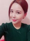 I became younger!! — Korea cost, reviews & before-after | MISOODA