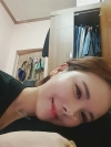 I became younger!! — Korea cost, reviews & before-after | MISOODA