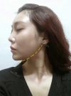 Misooda — Korea cost, reviews & before-after | MISOODA