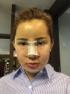 Jaw Reduction, Rhinoplasty and Breast Augmentation in Korea — Korea cost, reviews & before-after | MISOODA