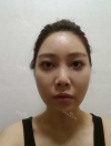 Misooda — Korea cost, reviews & before-after | MISOODA