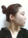 Misooda — Korea cost, reviews & before-after | MISOODA