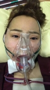 Jaw Reduction, Rhinoplasty and Breast Augmentation in Korea — Korea cost, reviews & before-after | MISOODA