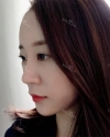 chin-+-rhinoplasty — Korea cost, reviews & before-after | MISOODA