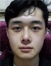 Misooda — Korea cost, reviews & before-after | MISOODA