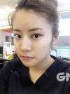 Square jaw reduction + Double eyelid revision surgery — Korea cost, reviews & before-after | MISOODA
