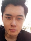 Misooda — Korea cost, reviews & before-after | MISOODA