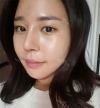 Rhinoplasty — Korea cost, reviews & before-after | MISOODA
