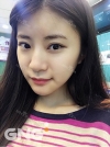 Square jaw reduction + Double eyelid revision surgery — Korea cost, reviews & before-after | MISOODA