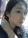 Scarless Smooth Face Line with Endoscopic Face Contouring by Romian — Korea cost, reviews & before-after | MISOODA
