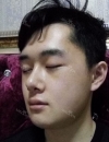 Misooda — Korea cost, reviews & before-after | MISOODA