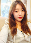 Nose and chin at jk ps clinic and got feminine look — Korea cost, reviews & before-after | MISOODA