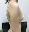 Jaw Reduction, Rhinoplasty and Breast Augmentation in Korea — Korea cost, reviews & before-after | MISOODA