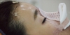 Forehead fat grafting + Rhinoplasty — Korea cost, reviews & before-after | MISOODA