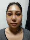 Misooda — Korea cost, reviews & before-after | MISOODA