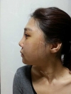 Misooda — Korea cost, reviews & before-after | MISOODA