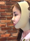 Jaw Reduction, Rhinoplasty and Breast Augmentation in Korea — Korea cost, reviews & before-after | MISOODA