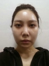 Misooda — Korea cost, reviews & before-after | MISOODA