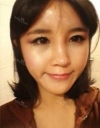 Forehead fat grafting + Rhinoplasty — Korea cost, reviews & before-after | MISOODA