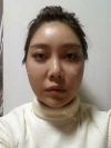 Misooda — Korea cost, reviews & before-after | MISOODA