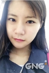 Square jaw reduction + Double eyelid revision surgery — Korea cost, reviews & before-after | MISOODA