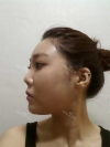 Misooda — Korea cost, reviews & before-after | MISOODA