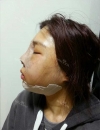 Misooda — Korea cost, reviews & before-after | MISOODA