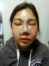 Misooda — Korea cost, reviews & before-after | MISOODA