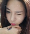 Rhinoplasty — Korea cost, reviews & before-after | MISOODA