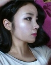 Forehead fat grafting + Rhinoplasty — Korea cost, reviews & before-after | MISOODA