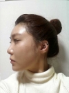 Misooda — Korea cost, reviews & before-after | MISOODA