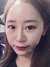 chin-+-rhinoplasty — Korea cost, reviews & before-after | MISOODA
