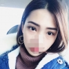 Incisional Double Eyelid, Lateral Canthoplasty, Eyelid Fat Removal — Korea cost, reviews & before-after | MISOODA