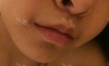 lips correction — Korea cost, reviews & before-after | MISOODA