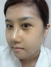 Misooda — Korea cost, reviews & before-after | MISOODA