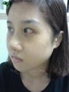 Misooda — Korea cost, reviews & before-after | MISOODA